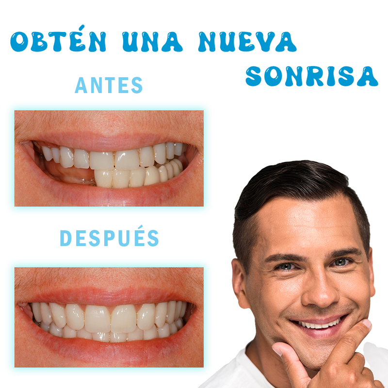 Molde para dentadura- Resina